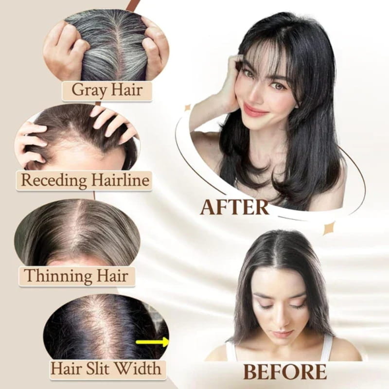 💁‍♀️ Natural Hair Toppers with Bangs – Undetectable Volume & Style! ✨👩🦰