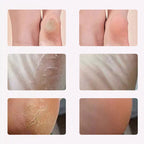 🔥HOT SALE 50% OFF🔥Electric Foot Scrubber for Smooth Healthy Skin