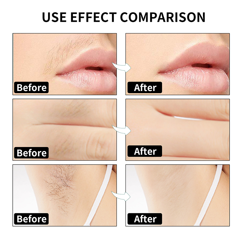 ⚡🫧2025  Hot Sale 50% OFF 🔥90PCS Body Hair Removal Wax Strips